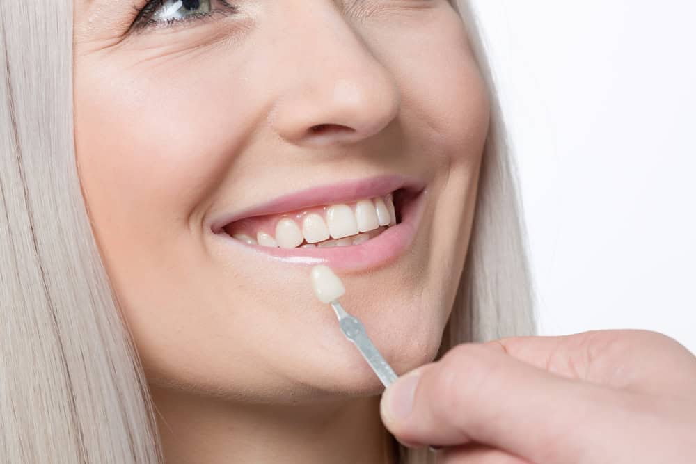 Dental Veneers in Greenville, NC Kevin Holley DMD PLLC dentist in Greenville NC DR. Kevin Holley