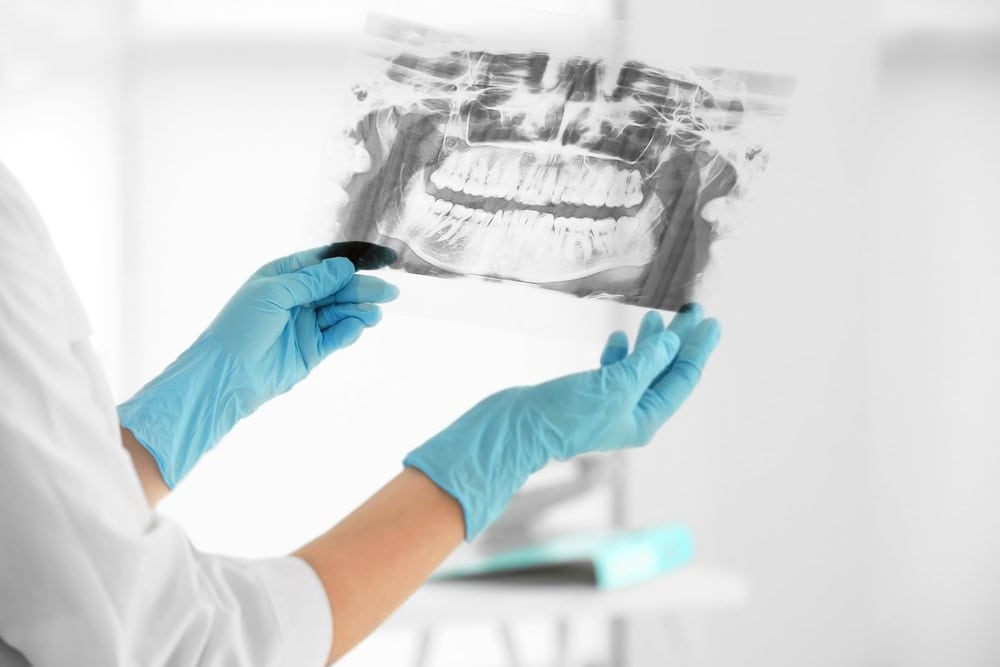 Dental X-Rays in Greenville Kevin Holley DMD PLLC dentist in Greenville NC DR. Kevin Holley
